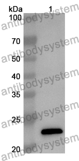 Anti-Mouse COL18A1 Polyclonal Antibody