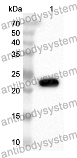 Anti-Mouse PGF/PlGF/PLGF Polyclonal Antibody