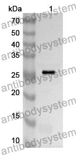 Anti-CTSC Polyclonal Antibody