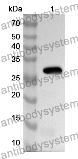 Anti-Mouse ANTXR2 Polyclonal Antibody