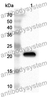 Anti-Mouse LCN2 Polyclonal Antibody