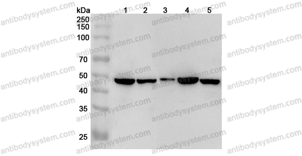 Anti-Mouse IL1RL1/ST2 Polyclonal Antibody