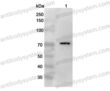 Anti-Mouse CD218a/IL18R1 Polyclonal Antibody