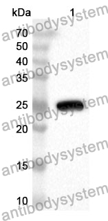 Anti-Mouse RAGE/AGER Polyclonal Antibody