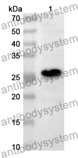 Anti-Mouse ECM1 Polyclonal Antibody