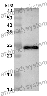 Anti-Mouse ADAMTS13 Polyclonal Antibody