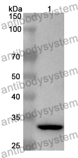 Anti-Mouse IL17RE Polyclonal Antibody