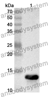 Anti-Mouse ACE2 Polyclonal Antibody