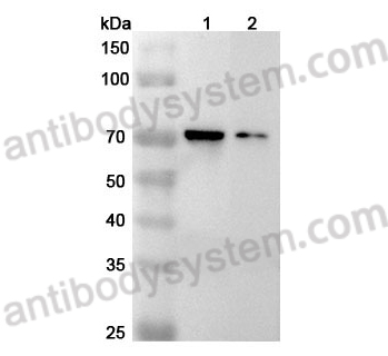 Anti-Mouse IL1RL2/IL-36R Polyclonal Antibody