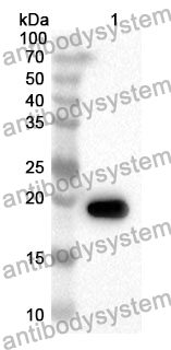 Anti-ESM1 Polyclonal Antibody