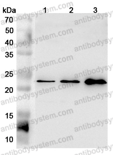 Anti-Mouse FGF21 Polyclonal Antibody