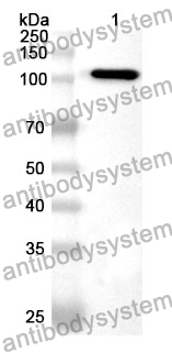 Anti-Mouse PADI4 Polyclonal Antibody