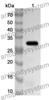 Anti-Mouse LOXL2 Polyclonal Antibody