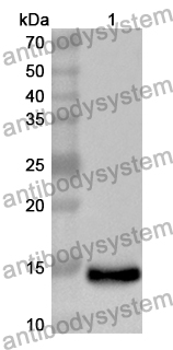 Anti-Mouse TIMD4/TIM-4 Polyclonal Antibody