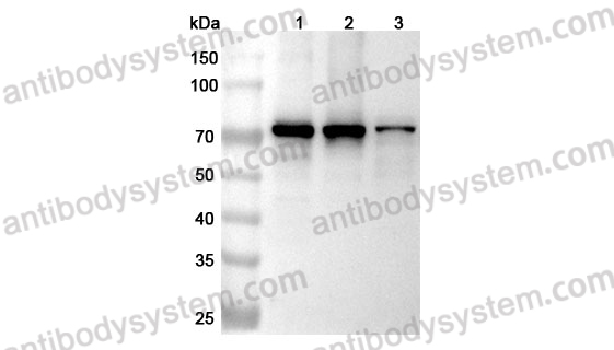 Anti-Mouse SPHK2 Polyclonal Antibody