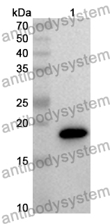 Anti-Mouse RNF43 Polyclonal Antibody