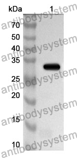 Anti-Mouse RTN4R Polyclonal Antibody