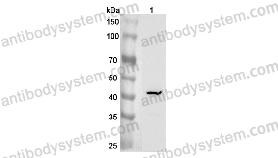 Anti-Mouse ST6GALNAC2/SIAT7-B Polyclonal Antibody