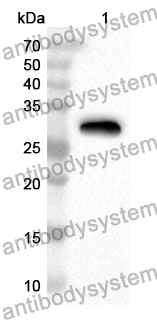 Anti-Mouse NTNG2/Netrin-G2 Polyclonal Antibody