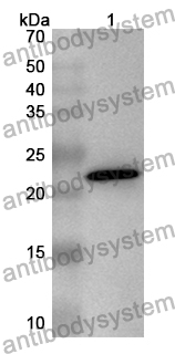 Anti-Mouse SNED1 Polyclonal Antibody