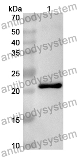 Anti-Mouse Ctf2 Polyclonal Antibody