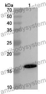 Anti-Pig CSF2/GM-CSF Polyclonal Antibody