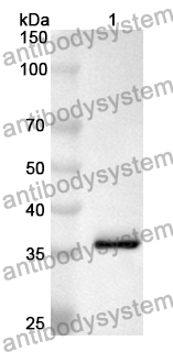 Anti-SARS-CoV-2 NTD Polyclonal Antibody