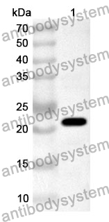 Anti-RBD Polyclonal Antibody