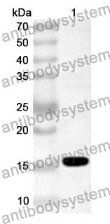 Anti-M Protein Polyclonal Antibody