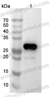 Anti-E1B-55K/E1B-495R Polyclonal antibody