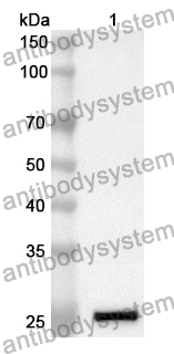 Anti-Lassa virus/LASV GPC Polyclonal Antibody