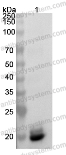 Anti-Lassa virus/LASV GPC Polyclonal Antibody