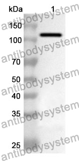 Anti-HAdV-5 L3/CP-H/Protein II Polyclonal Antibody