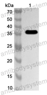Anti-HSV-1/HHV-1 gG/US4 Polyclonal Antibody