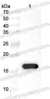 Anti-HBV X/HBx Polyclonal Antibody