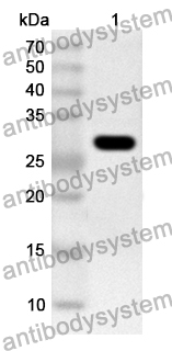 Anti-ASFV p72/B646L Polyclonal Antibody