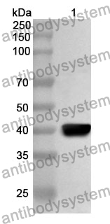 Anti-VP7 Polyclonal Antibody