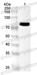 Anti-HPV16 L1/Major capsid Polyclonal Antibody L1 Polyclonal Antibody