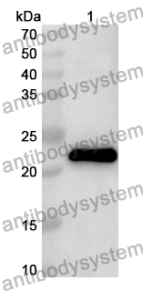 Anti-HPV18 E6/Protein E6 Polyclonal Antibody