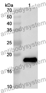 Anti-HBV C/Capsid protein Polyclonal Antibody