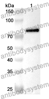 Anti-HPV18 L1/Major capsid protein L1 Polyclonal Antibody