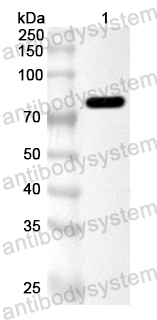 Anti-HPV18 L1/Major capsid Polyclonal Antibody L1 Polyclonal Antibody