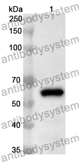 Anti-Hepatitis E virus genotype 1/HEV-1 ORF2 Polyclonal Antibody