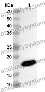 Anti-Hepatitis E virus genotype 1/HEV-1 ORF2 Polyclonal Antibody