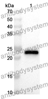 Anti-Monkeypox virus B21R Polyclonal Antibody