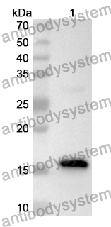 Anti-Monkeypox virus/MPXV D6L Polyclonal Antibody