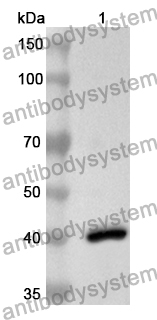 Anti-Monkeypox virus/MPXV B16R Polyclonal Antibody