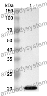 Anti-HPV52 E6/Protein E6 Polyclonal Antibody