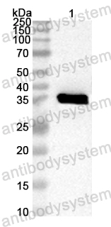 Anti-CA6 VP1/P1D Polyclonal Antibody