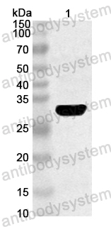 Anti-CA6 VP2/P1B Polyclonal Antibody